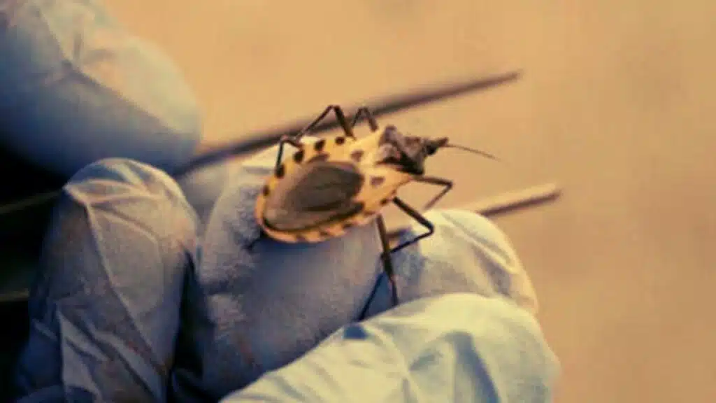 Chagas Disease