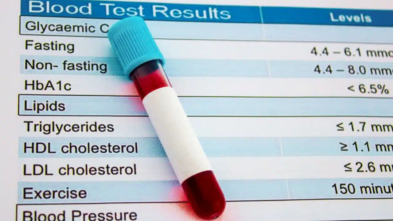crispr gene therapy cholesterol