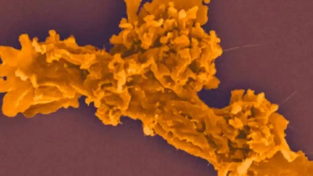 scientists discover amoeba thriving at record 145°F