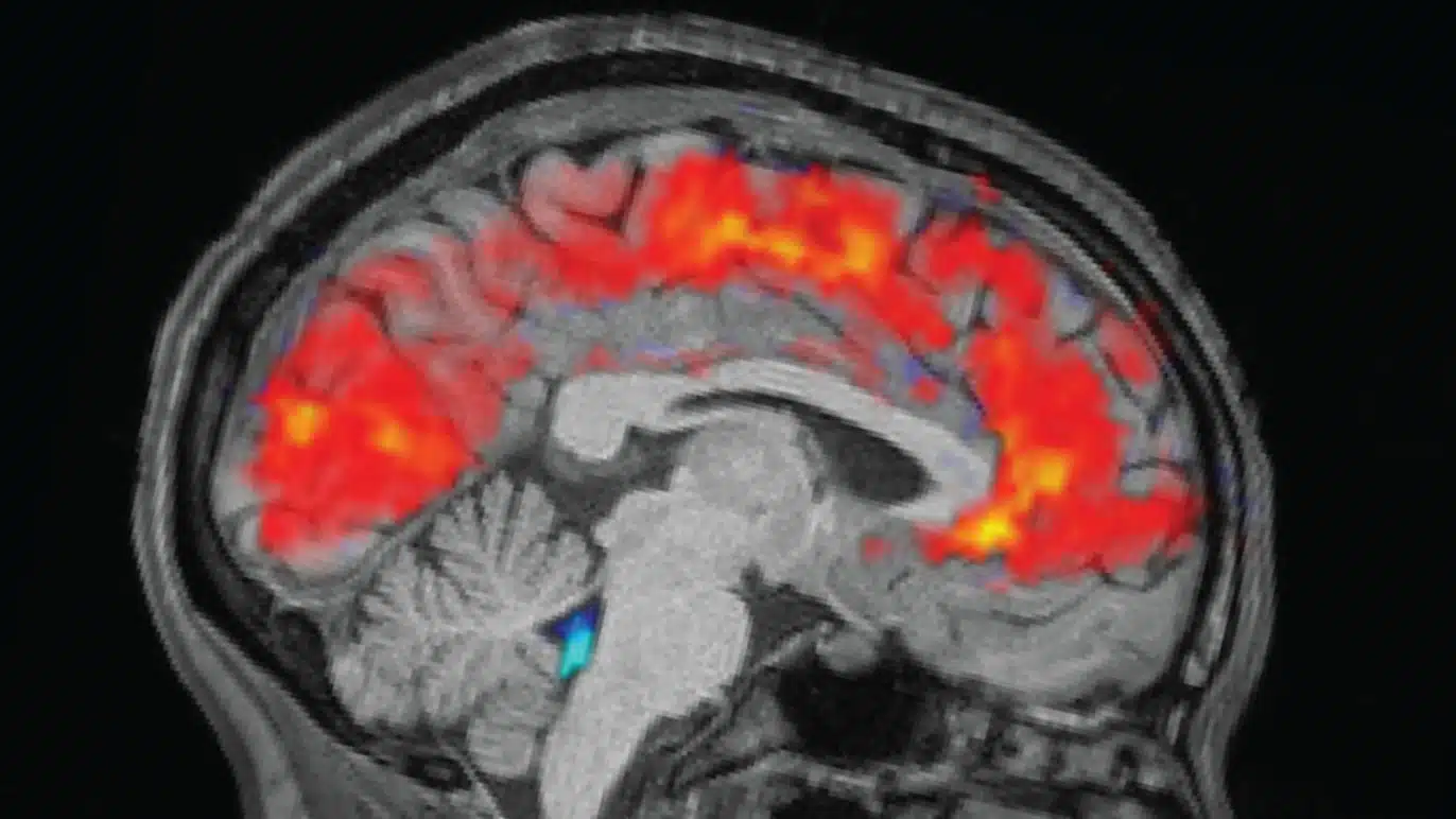 fMRI Brain Scans Misread